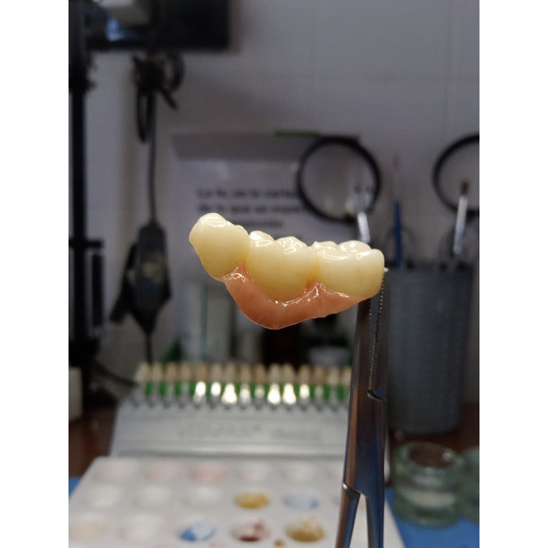 Corona Zirconia