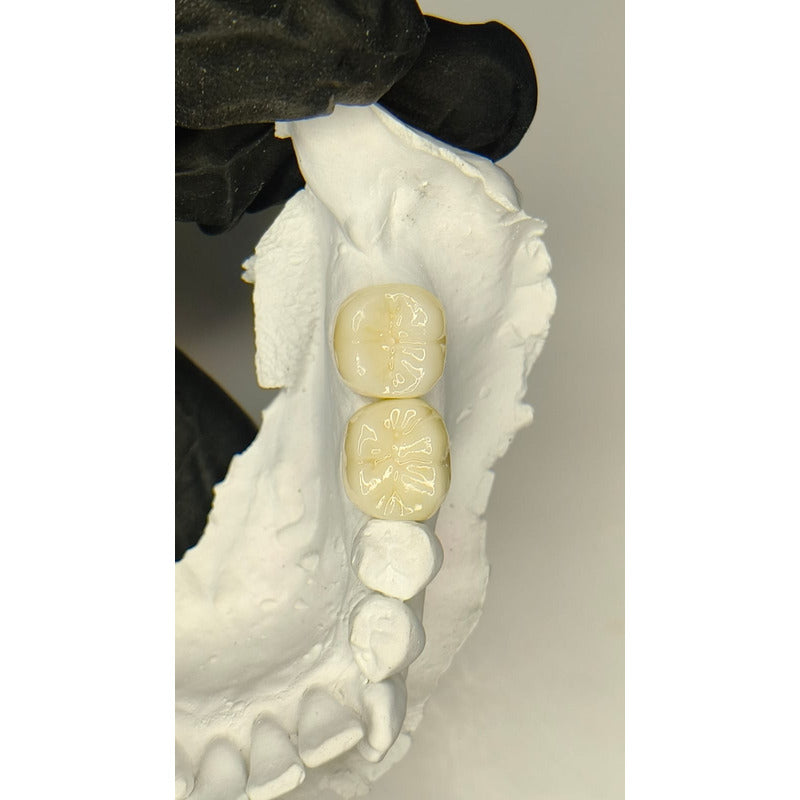 Corona Zirconia
